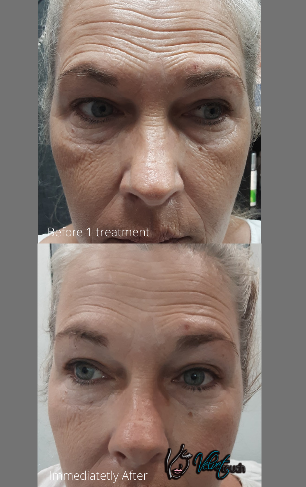 DonnaFurr-WIQO-frontpage-rev.01 Skin Care - Velvet Touch TX